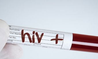 HIV positive stick